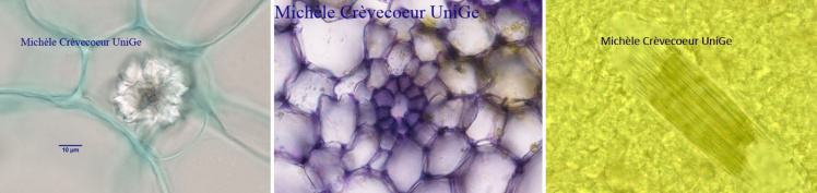 cellules secretrices
