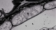 Cellule de l'endosperme d'Arabidopsis th.