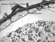 Endosperme d'Arabidopsis 