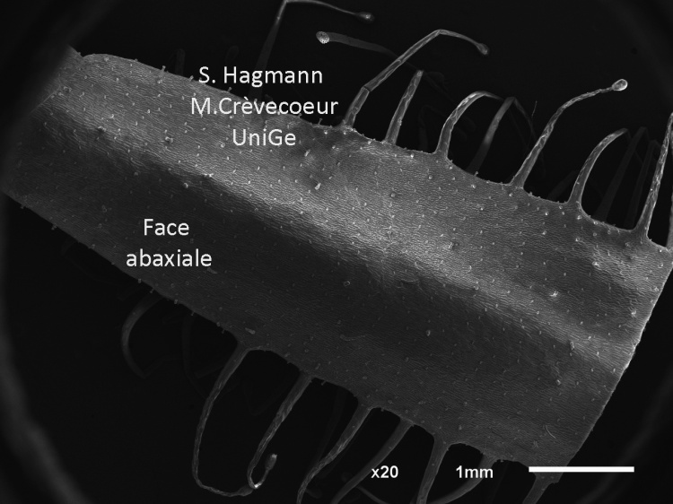 Face Abaxiale Feuille de Drosera
