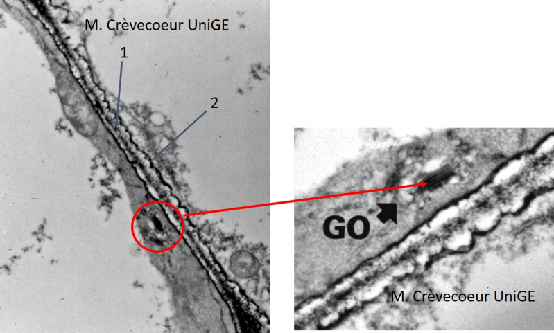 Peroxidase MET.jpg