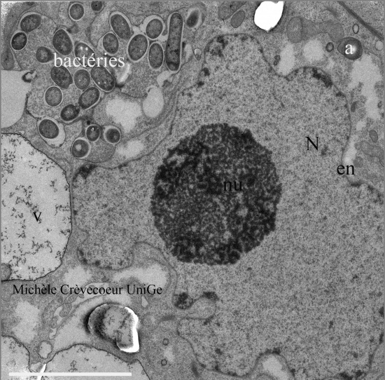 Nodule - partie apicale -NGR234 Leucaena l