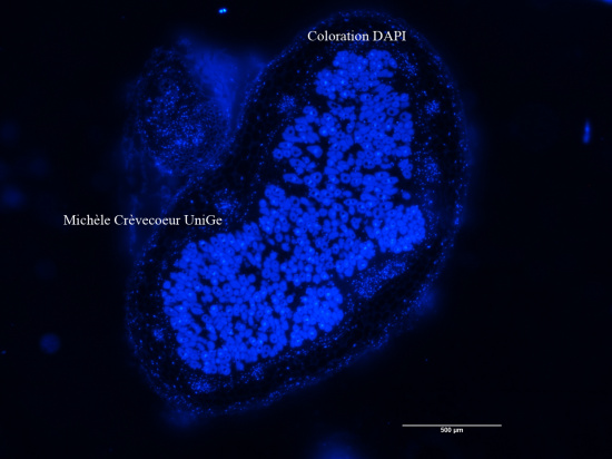DAP coupe paraffine nodule