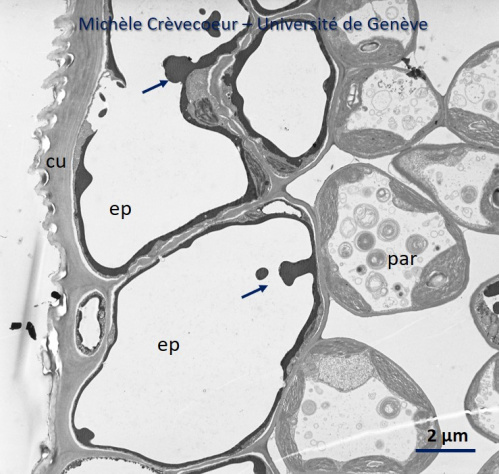 Epiderme de feuille de merisier