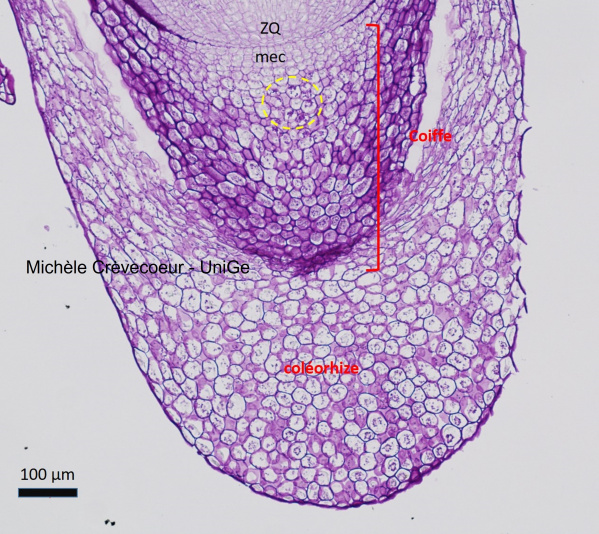 Site PAS parenchyme coiffe 1