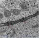 Plasmodesmes cellule méristématique