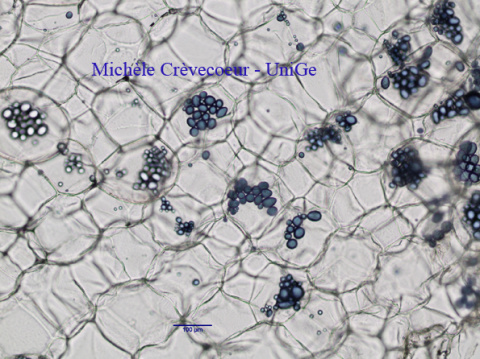 Site parenchyme pdt Lugol 10xa.jpg