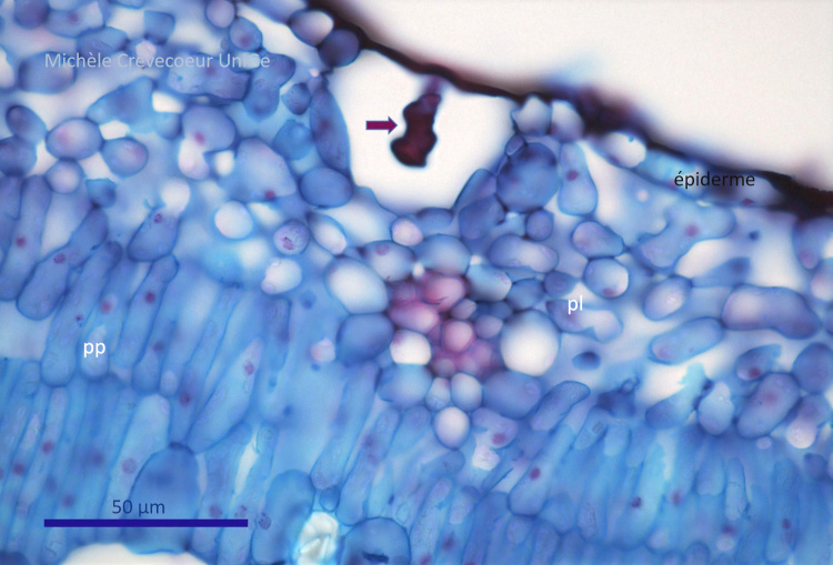 Cystolith feuille figuier