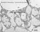 Parenchyme de feuille de merisier