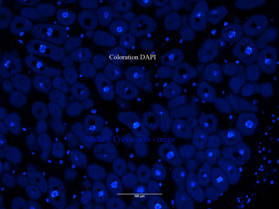 DAPI coupe paraffine nodule 2