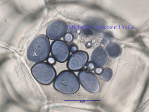 Site cell parenchyme pdt Lugol 10xa.jpg