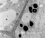 Localisation des polysaccharides (test PATAg) 